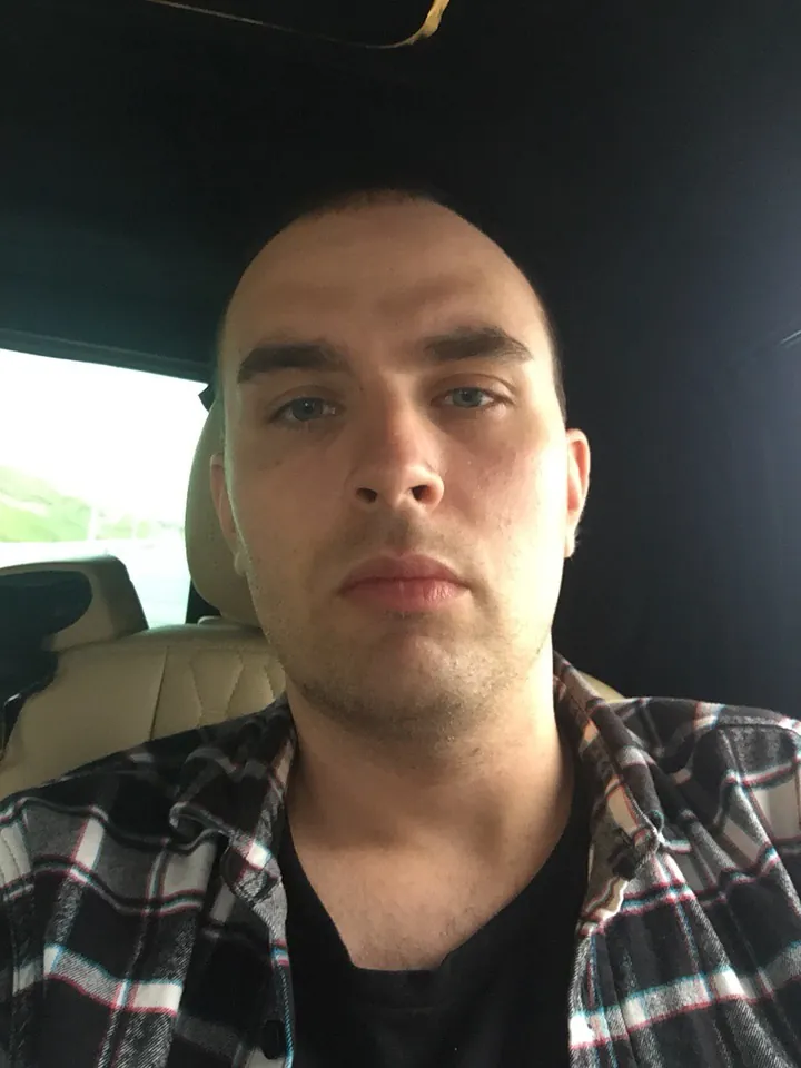 Before my hair transplant — receding hairline, July 2020, on the way to the clinic