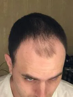 6 months — top